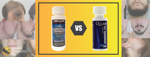 Kirkland vs QGain, avagy melyik minoxidil a jobb szakállnövesztéshez?