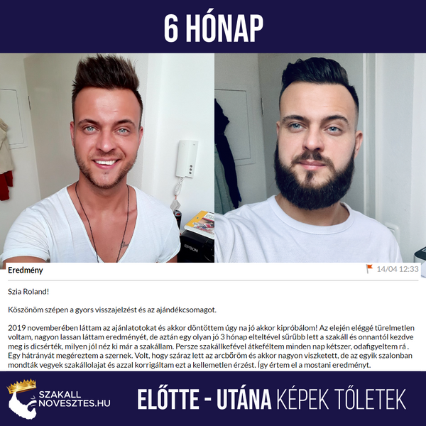 Great Barrier Reef timeren Optage Kirkland 5%-os Minoxidil Hab - 3 havi adagos Szakállnövesztő -  Szakallnovesztes.hu