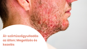 Ál-szőrtüszőgyulladás az állon: Megelőzés és kezelés