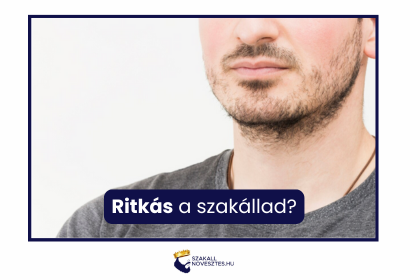 Ritkás a szakállad?