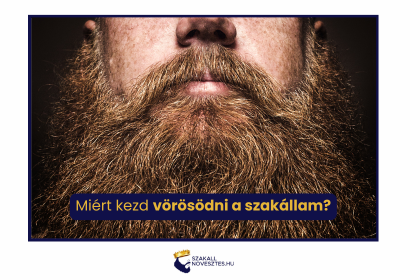 Miért kezd vörösödni a szakállam?