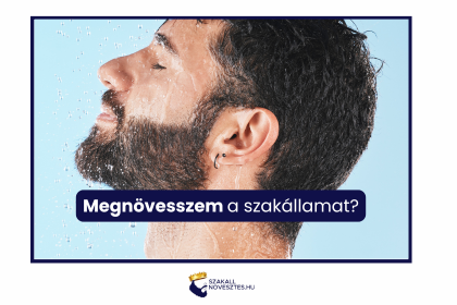 Megnövesszem a szakállamat?