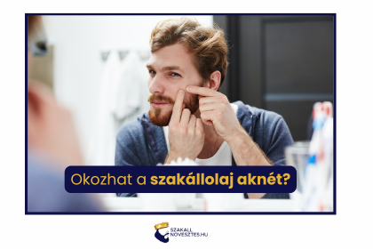 Okozhat a szakállolaj aknét?