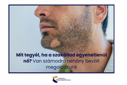 Mit tegyél, ha a szakállad egyenetlenül nő? Van számodra néhány bevált megoldásunk.