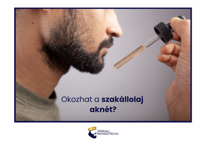 Okozhat a szakállolaj aknét?