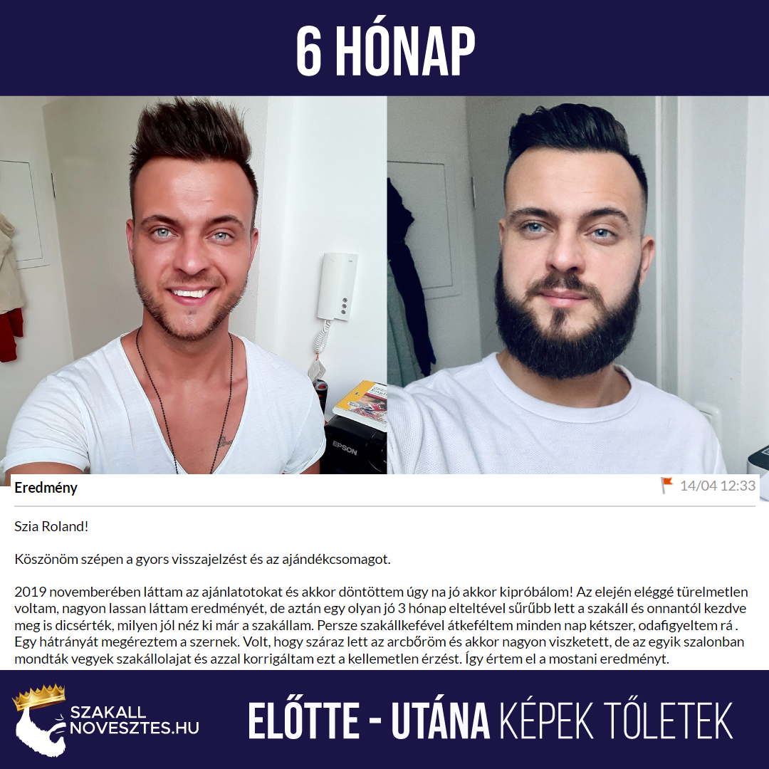 Kirkland 5%-os Minoxidil Hab - 3 havi adag